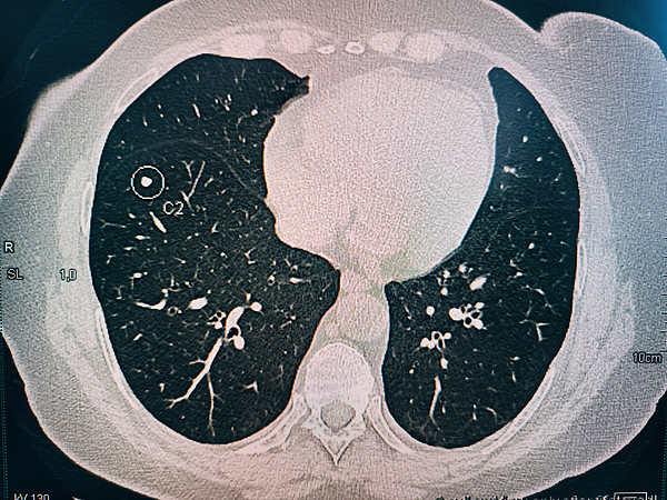 IMG_20250321_165010. 