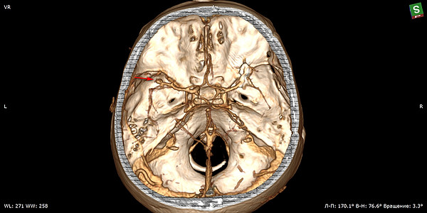 3. �� ��������. 