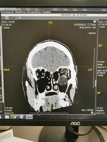 IMG_20211025_103854. 